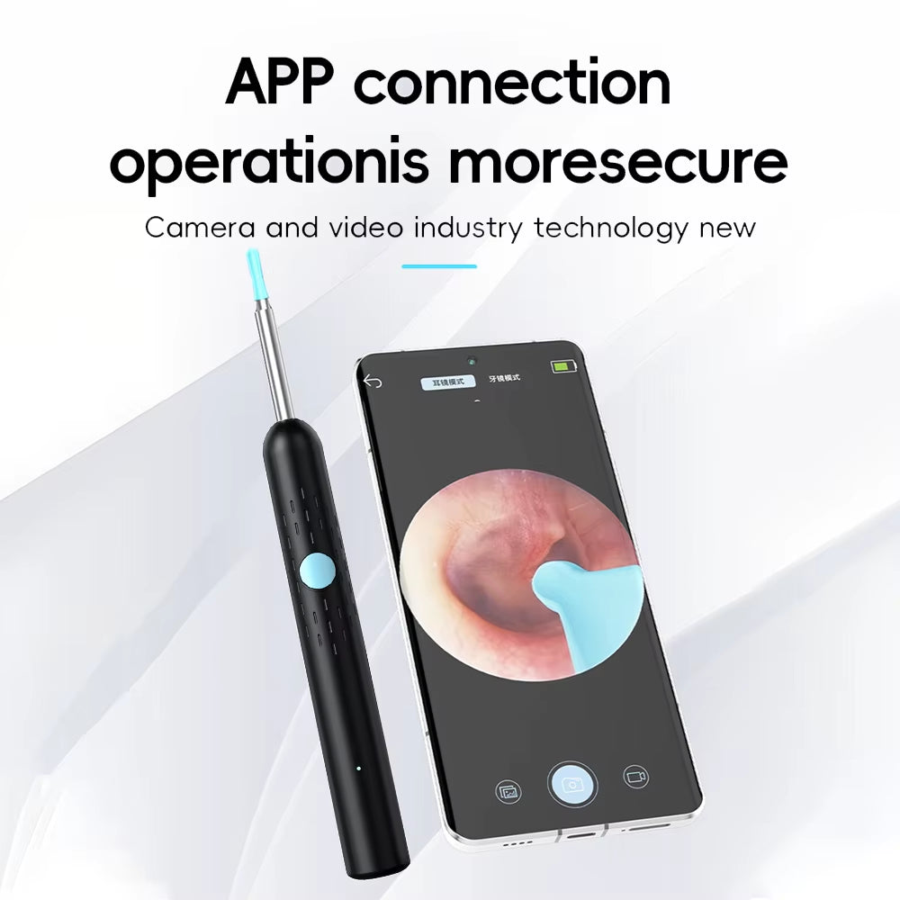 Smart Ear Cleaner with Camera & LED – Wireless Wax Removal Tool
