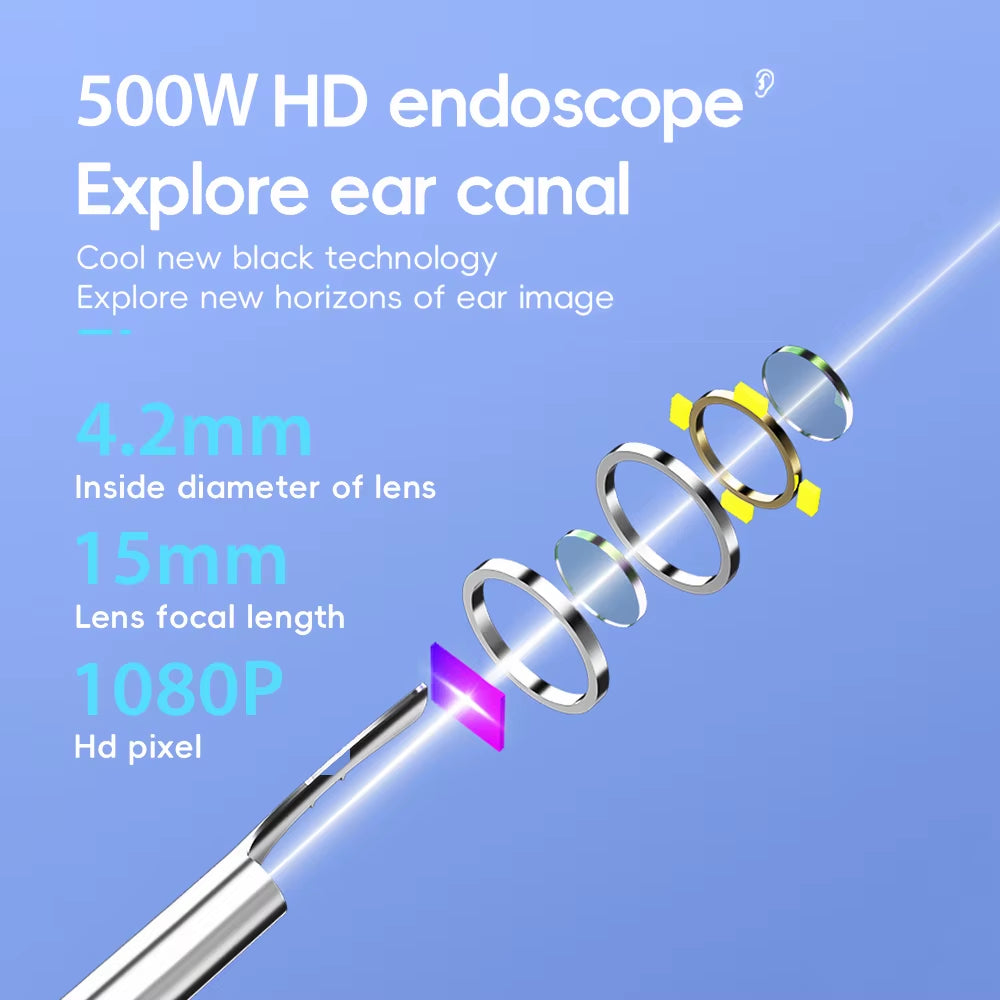 Smart Ear Cleaner with Camera & LED – Wireless Wax Removal Tool